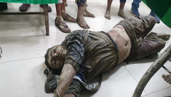 মৌলভীবাজারের ডাকাতের গুলিতে ডাকাত গুলিবিদ্ধ, ২১ রাউন্ড গুলি ও পাইপগান সহ ডাকাত আটক